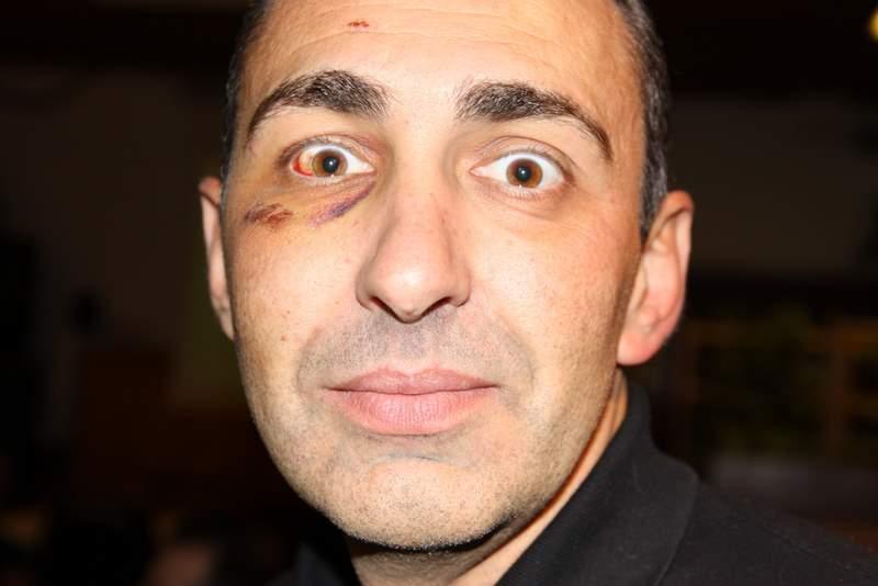 occhio nero.JPG
